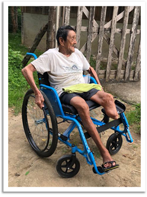 Jose, in Costa Rica, had his left leg amputated due to an infection.