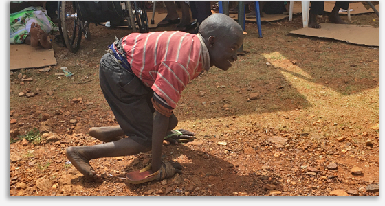 50-year-old Robert in Uganda cannot walk and has been forced to crawl for his entire life.